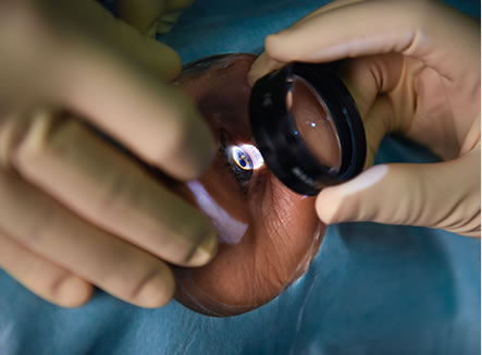 Chirurgia vitreo retinica