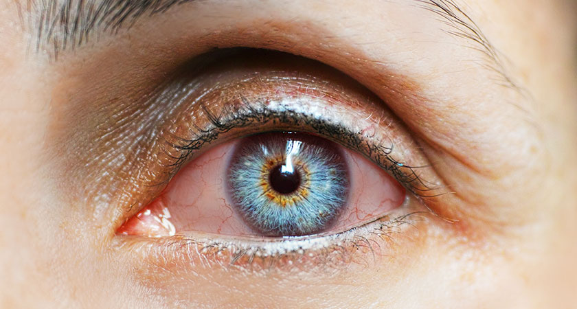 Le cause del distacco della retina